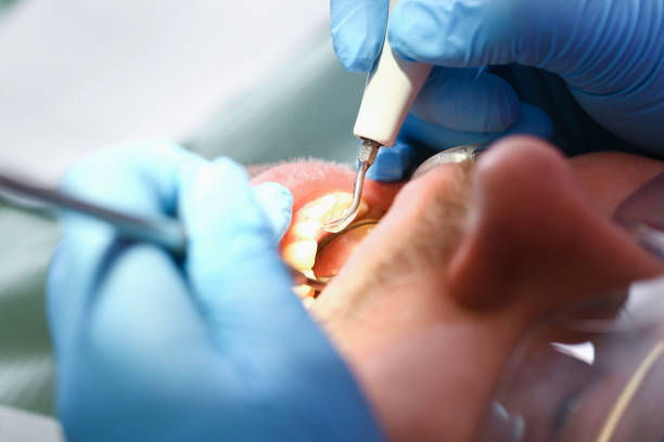 Best Emergency Treatment for Toothache in Arcola, TX