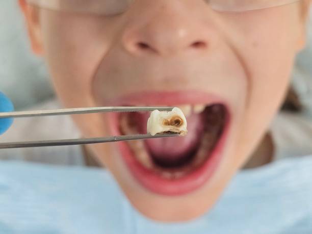 Best Pediatric Emergency Dentist in Arcola, TX